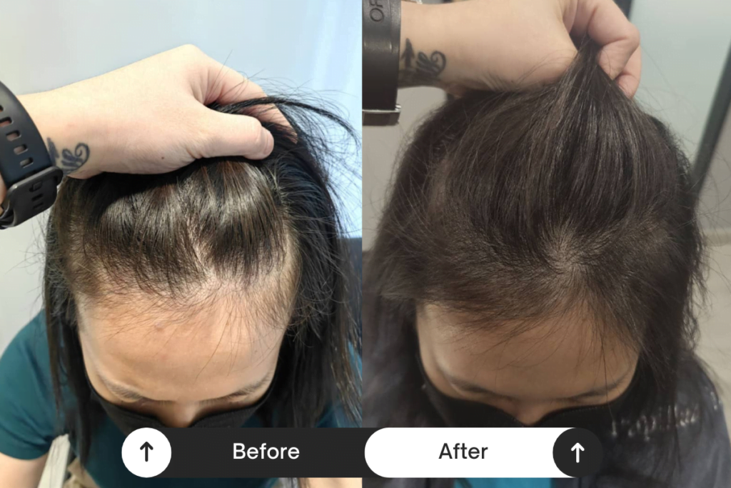 Beige Minimalist Skincare Before and After Instagram Post (1)