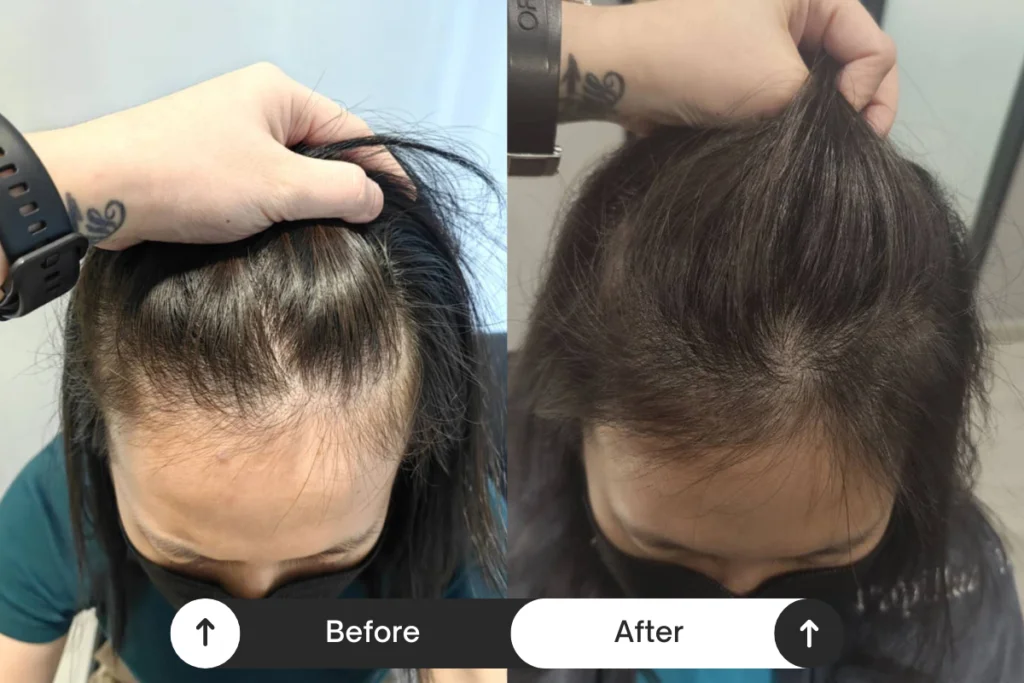 Beige Minimalist Skincare Before and After Instagram Post (1)