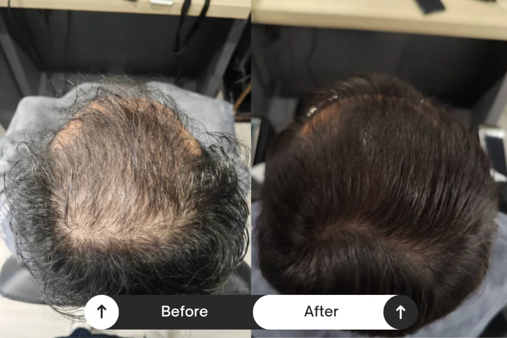 Beige Minimalist Skincare Before and After Instagram Post (2)
