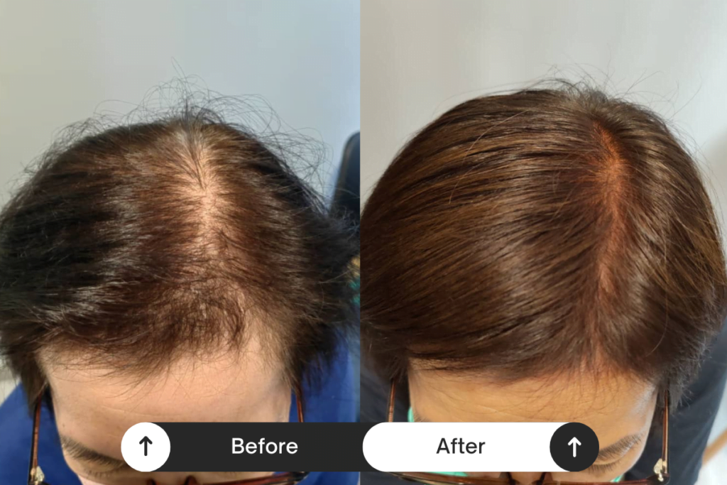 Beige Minimalist Skincare Before and After Instagram Post (3)