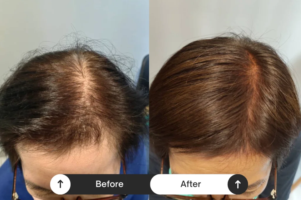 Beige Minimalist Skincare Before and After Instagram Post (3)
