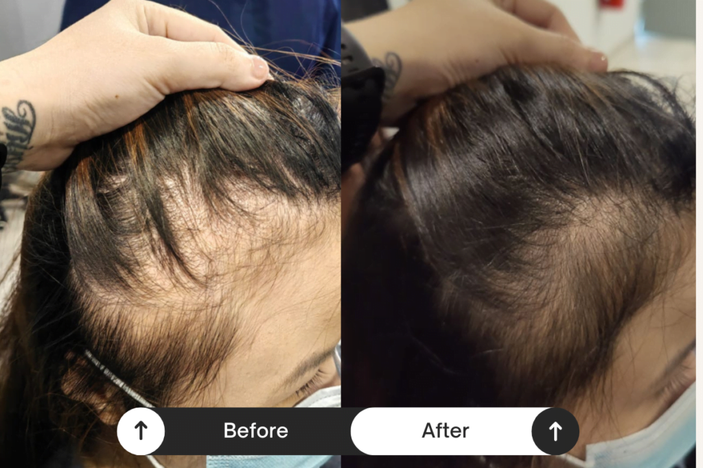 Beige Minimalist Skincare Before and After Instagram Post (4)