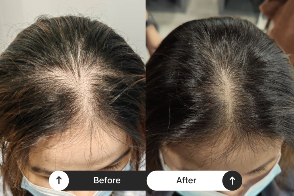 Beige Minimalist Skincare Before and After Instagram Post (5)