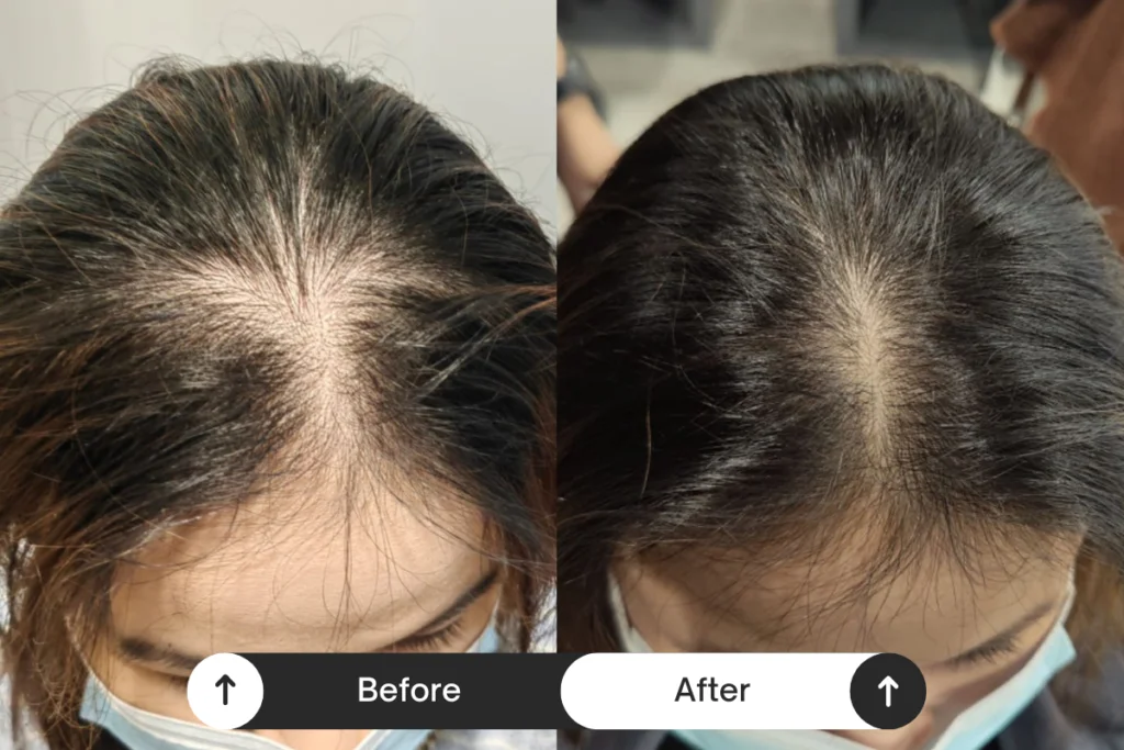 Beige Minimalist Skincare Before and After Instagram Post (5)