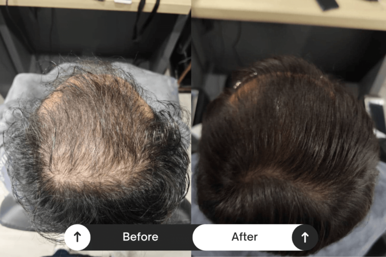 Beige-Minimalist-Skincare-Before-and-After-Instagram-Post-2 tiny