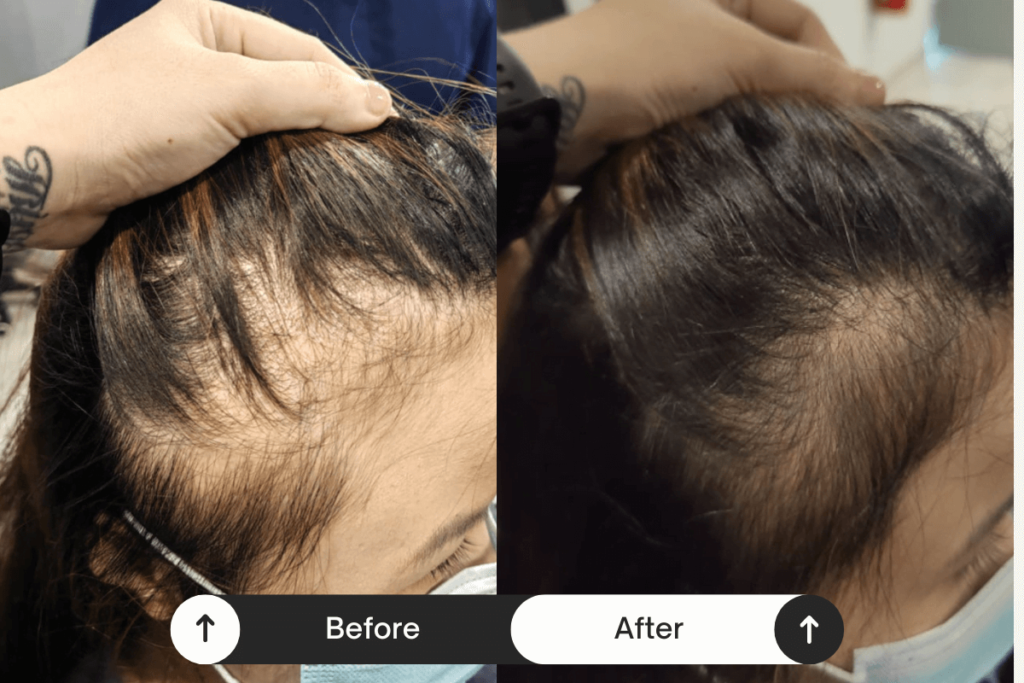 Beige-Minimalist-Skincare-Before-and-After-Instagram-Post-4 tiny