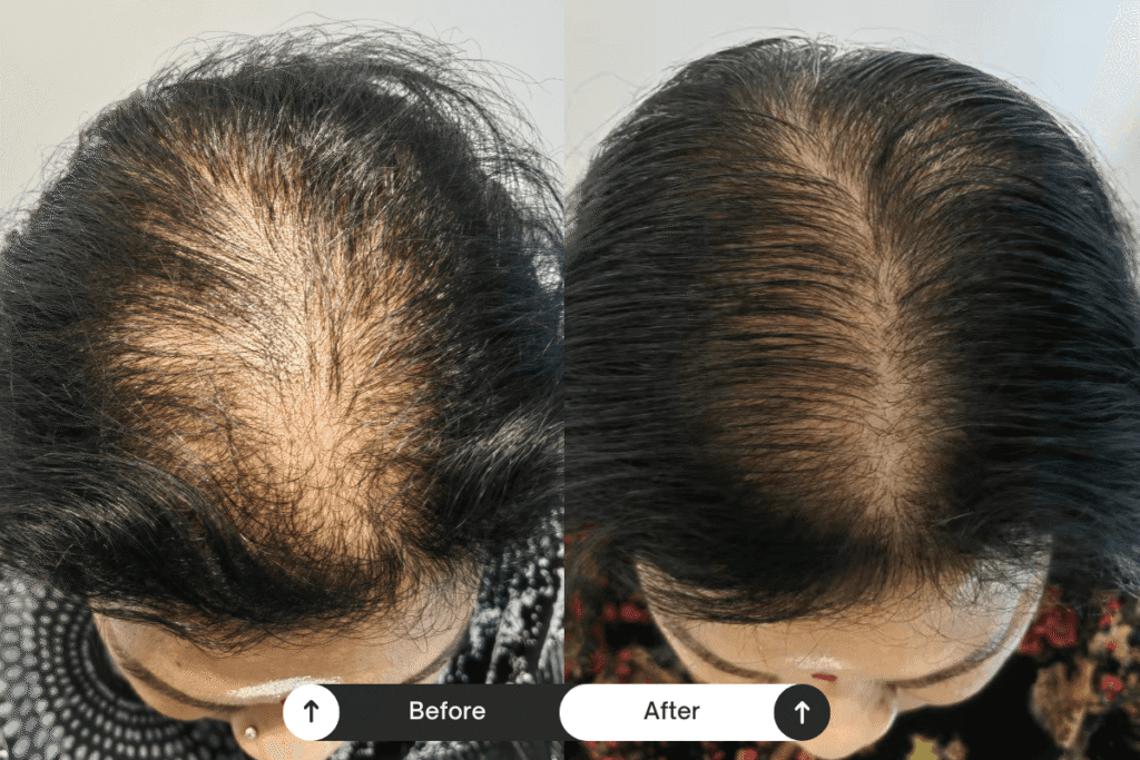 scalp treament before after 06
