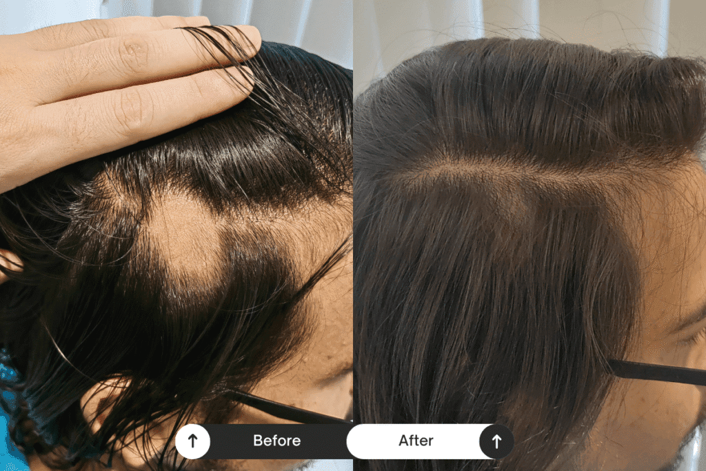 scalp treament before after 07