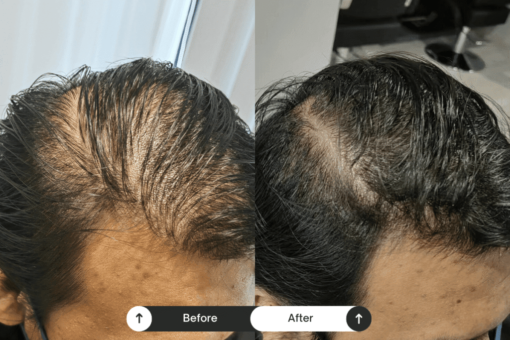 scalp treament before after 10